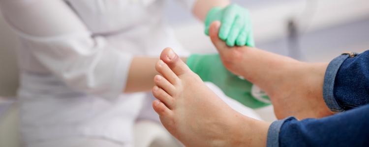 main of Diabetic Foot Can Be the Result Of Unbalanced Blood Sugars for Diabetics